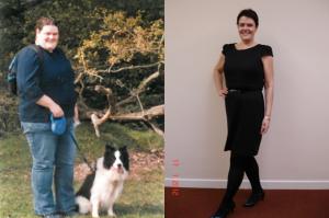 before-after